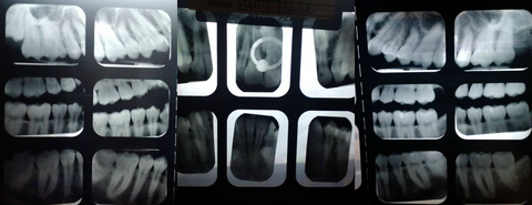 Leaked human_lamprey header onlyfans leaked